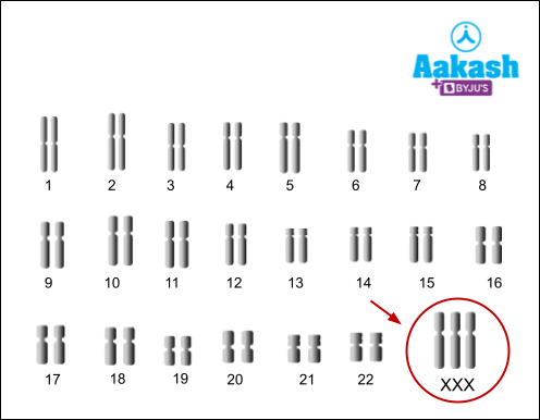 Chromosomal Disorders: Types, Symptoms & Chromosomal Disorders